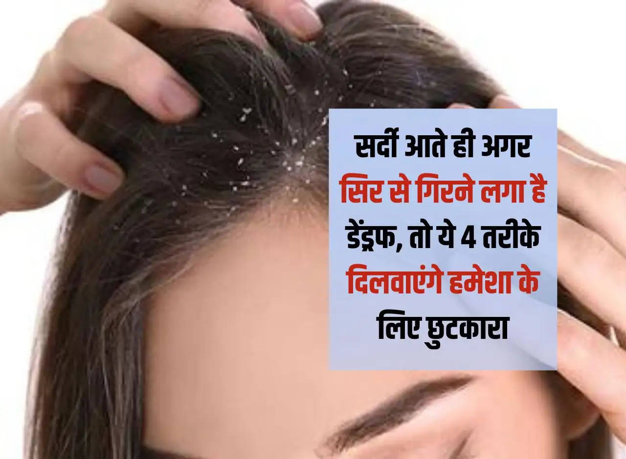 If dandruff starts falling from the head as soon as winter comes, then these 4 methods will get rid of it forever.