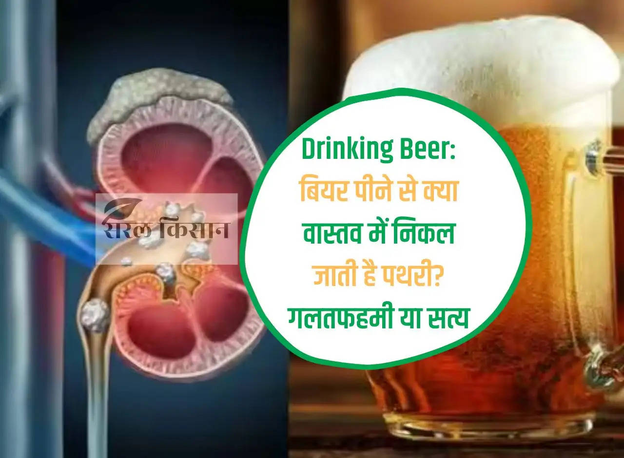 Drinking Beer: Can drinking beer really remove stones? misunderstanding or truth