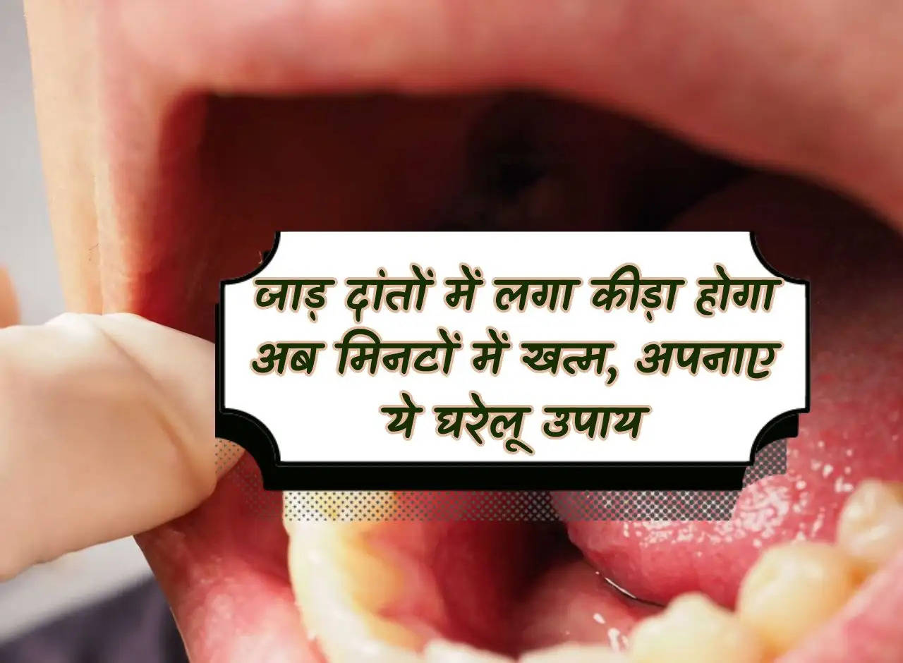 Now the worm stuck in the teeth will be gone within minutes, adopt these home remedies